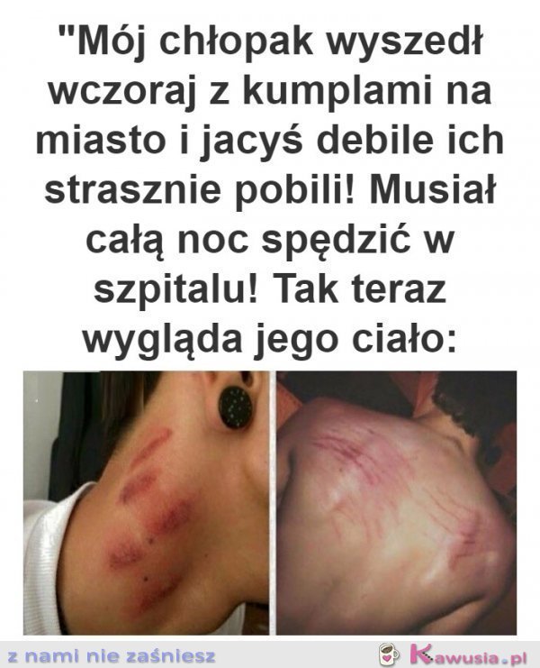 Mój biedny chłopak strasznie go pobili