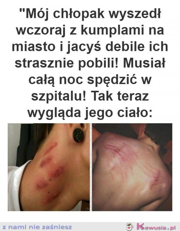 Mój biedny chłopak strasznie go pobili