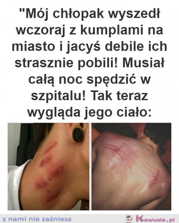 Mój biedny chłopak strasznie go pobili