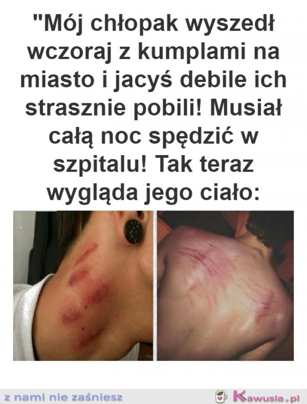 Mój biedny chłopak starsznie go pobili