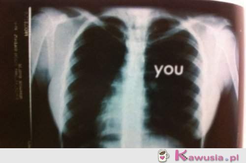 You   