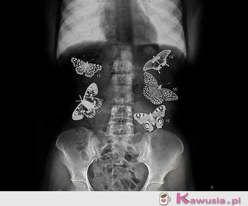 Motylki w brzuchu...